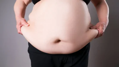 Dünya Obezite Federasyonu tarafından paylaşılan 2026 Dünya Obezite Atlası raporunda